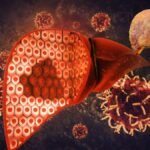 Fatty Liver Dangerous For Health