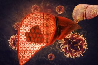 Fatty Liver Dangerous For Health