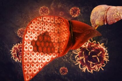 Fatty Liver Dangerous For Health